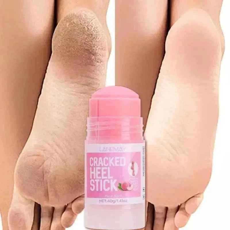 Foot Repair Cream